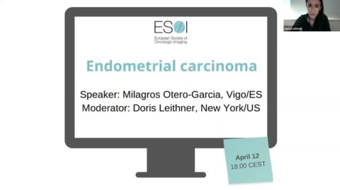 Endometrial carcinoma (2023) | ESOI